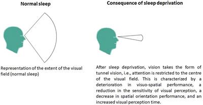 Detrimental effects of sleep deprivation on the regulatory mechanisms of postural balance: a comprehensive review